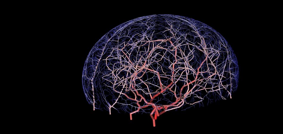 Reconstructing the Cerebral Vascular Network