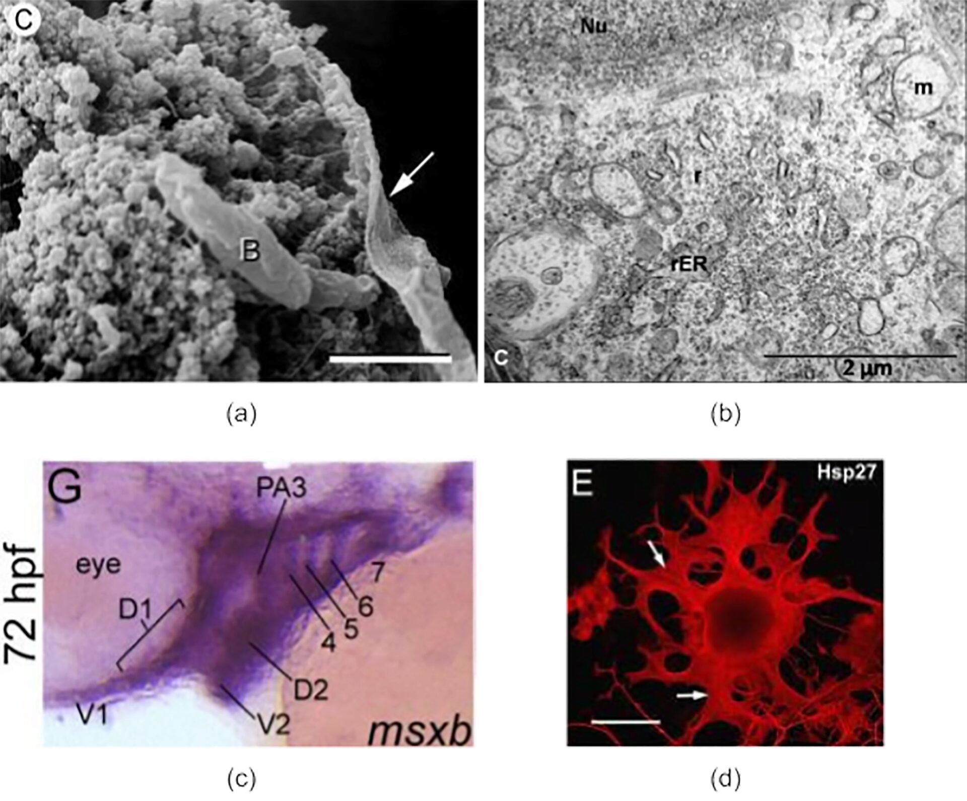Modality-Classification of Microscopy Images Using Shallow Variants of Deep Networks