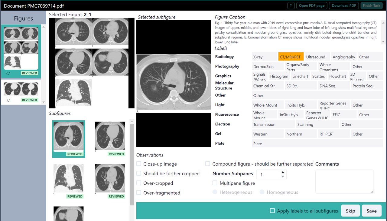 PhD Prelim Announcement: Integrating Image Features to Support the Biocuration Workflow