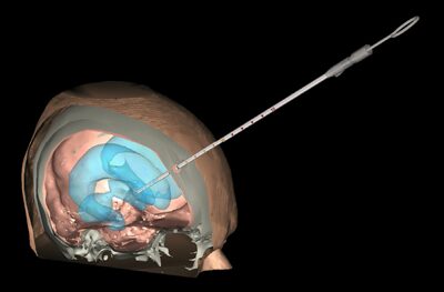 PhD Dissertation: Open Surgery Training Simulator