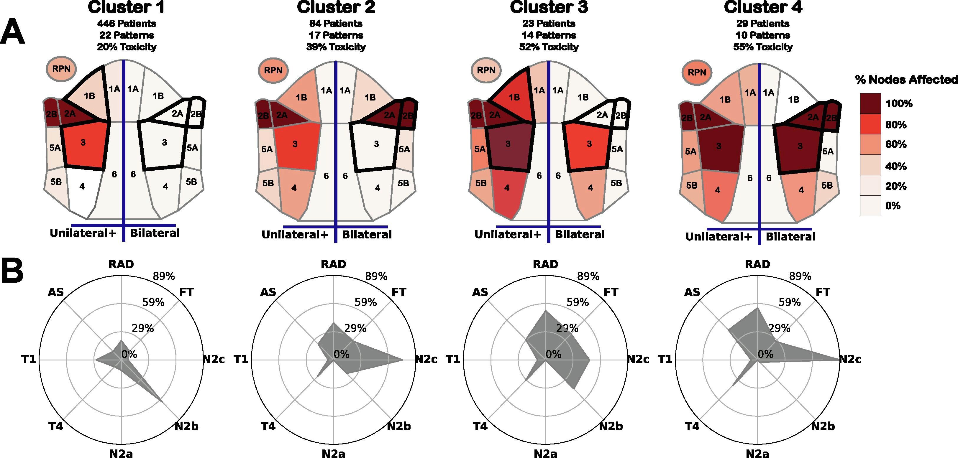 Precision association of lymphatic disease spread with radiation-associated toxicity in oropharyngeal squamous carcinomas