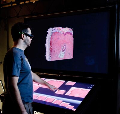 Immunohistochemical Evaluation of Bleeding Control Induced by Holmium Laser and Biolase Dental Laser As Coagulting Devices of Incisional Wounds