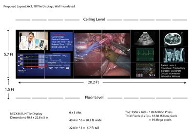 Visualization Wall for OR of the Future