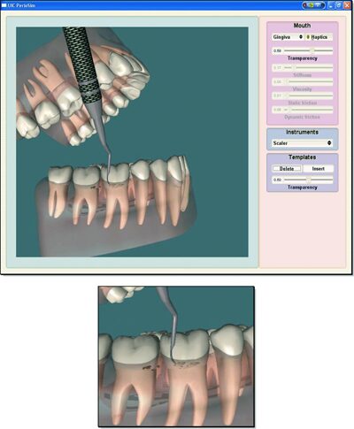 Haptics-based virtual reality periodontal training simulator