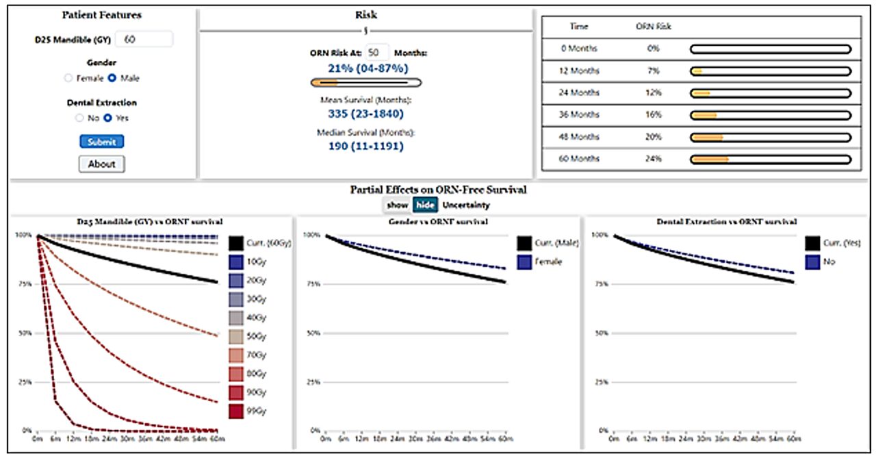 Externally validated digital decision support tool for time-to-osteoradionecrosis risk-stratification using right-censored multi-institutional observational cohorts