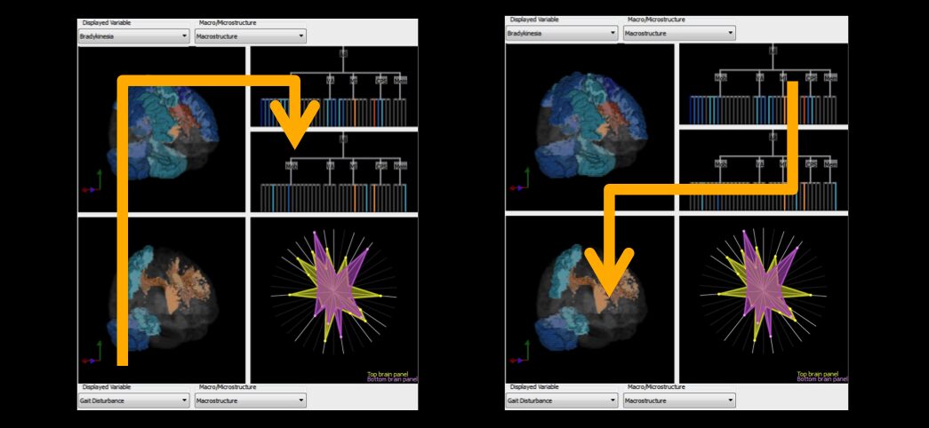 Visual Scaffolding in Integrated Spatial and Nonspatial Analysis