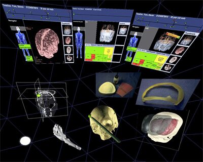 CrEdit: Tele-Immersive Cranial Impant Design in a Haptic Augmented Reality Environment